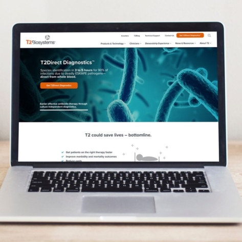 T2 Biosystems preview